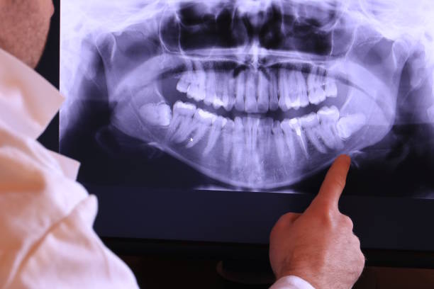Best Emergency Gum Treatment in Walnut Park, CA